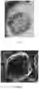 Fig. 06 - Hollow carbon sphere with multi-stage pore structure and preparation method therefor