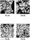 Fig. 10 - STRUCTURALLY MODIFIED OPIOIDS FOR PREVENTION AND TREATMENT OF DISEASES AND CONDITIONS