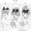 Fig. 18 - ZIRCONIUM-89 OXINE COMPLEX AS A CELL LABELING AGENT FOR POSITRON EMISSION TOMOGRAPHY
