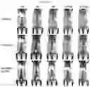 Fig. 26 - ZIRCONIUM-89 OXINE COMPLEX AS A CELL LABELING AGENT FOR POSITRON EMISSION TOMOGRAPHY