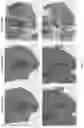 Fig. 15 - MODIFIED PEPTIDE NUCLEIC ACID COMPOSITIONS