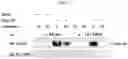 Fig. 05 - CONFORMATIONAL EPITOPE OF HEPATITIS B SURFACE ANTIGEN AND ANTIBODY BINDING SPECIFICALLY THERETO