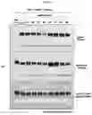 Fig. 20 - CONFORMATIONAL EPITOPE OF HEPATITIS B SURFACE ANTIGEN AND ANTIBODY BINDING SPECIFICALLY THERETO