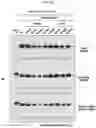 Fig. 25 - CONFORMATIONAL EPITOPE OF HEPATITIS B SURFACE ANTIGEN AND ANTIBODY BINDING SPECIFICALLY THERETO
