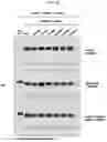 Fig. 26 - CONFORMATIONAL EPITOPE OF HEPATITIS B SURFACE ANTIGEN AND ANTIBODY BINDING SPECIFICALLY THERETO