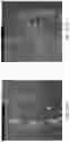 Fig. 154 - Compositions, formulations and interleukin production and purification