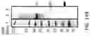 Fig. 182 - Compositions, formulations and interleukin production and purification
