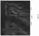 Fig. 90 - Compositions, formulations and interleukin production and purification