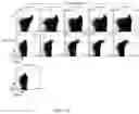 Fig. 04 - MOLECULES THAT SELECTIVELY ACTIVATE REGULATORY T CELLS FOR THE TREATMENT OF AUTOIMMUNE DISEASES
