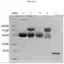 Fig. 20 - METHODS OF PRODUCING AND USING RECOMBINANT ALPHA 1-ANTITRYPSIN (AAT) AND COMPOSITIONS THEREOF