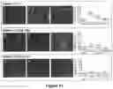 Fig. 10 - METHODS FOR REDUCING POST-OPERATIVE COGNITIVE DYSFUNCTION (POCD)