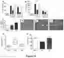 Fig. 12 - METHODS FOR REDUCING POST-OPERATIVE COGNITIVE DYSFUNCTION (POCD)