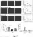 Fig. 15 - METHODS FOR REDUCING POST-OPERATIVE COGNITIVE DYSFUNCTION (POCD)