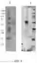 Fig. 22 - SINGLE DOMAIN ANTIBODIES AGAINST CLL-1