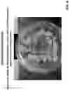 Fig. 06 - COMPOSITION, SYSTEM AND METHOD FOR TREATING STAINS AND ODORS