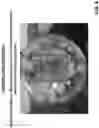 Fig. 07 - COMPOSITION, SYSTEM AND METHOD FOR TREATING STAINS AND ODORS
