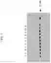 Fig. 05 - AUXOTROPHIC STRAINS OF STAPHYLOCOCCUS BACTERIUM