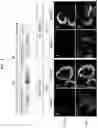 Fig. 09 - PRODUCTION METHOD FOR NERVE TISSUE