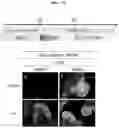 Fig. 12 - PRODUCTION METHOD FOR NERVE TISSUE
