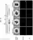 Fig. 14 - PRODUCTION METHOD FOR NERVE TISSUE
