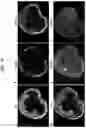 Fig. 28 - PRODUCTION METHOD FOR NERVE TISSUE