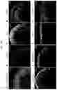 Fig. 29 - PRODUCTION METHOD FOR NERVE TISSUE