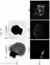 Fig. 30 - PRODUCTION METHOD FOR NERVE TISSUE