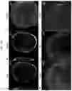 Fig. 32 - PRODUCTION METHOD FOR NERVE TISSUE