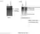 Fig. 135 - Universal donor stem cells and related methods