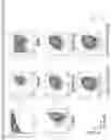 Fig. 34 - Universal donor stem cells and related methods