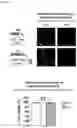 Fig. 16 - NANOCOIL-SUBSTRATE COMPLEX FOR CONTROLLING STEM CELL BEHAVIOR, PREPARATION METHOD THEREOF, AND METHOD OF CONTROLLING ADHESION AND DIFFERENTIATION OF STEM CELL BY USING THE SAME