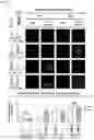 Fig. 18 - NANOCOIL-SUBSTRATE COMPLEX FOR CONTROLLING STEM CELL BEHAVIOR, PREPARATION METHOD THEREOF, AND METHOD OF CONTROLLING ADHESION AND DIFFERENTIATION OF STEM CELL BY USING THE SAME