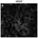 Fig. 01 - VASCULARIZED ORGANOID MODEL INCORPORATING ISOLATED HUMAN MICROVESSEL FRAGMENTS
