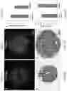 Fig. 04 - VASCULARIZED ORGANOID MODEL INCORPORATING ISOLATED HUMAN MICROVESSEL FRAGMENTS