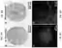 Fig. 07 - VASCULARIZED ORGANOID MODEL INCORPORATING ISOLATED HUMAN MICROVESSEL FRAGMENTS