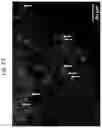 Fig. 13 - VASCULARIZED ORGANOID MODEL INCORPORATING ISOLATED HUMAN MICROVESSEL FRAGMENTS