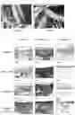 Fig. 11 - MESENCHYMAL STEM CELLS DERIVED FROM SYNOVIUM AND USES THEREOF