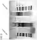 Fig. 11 - NOVEL ALPHA-GALACTOSIDASE A DERIVATIVES