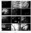 Fig. 06 - METHODS FOR DIAGNOSING AND TREATING METASTATIC CANCER