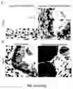 Fig. 12 - METHODS FOR DIAGNOSING AND TREATING METASTATIC CANCER