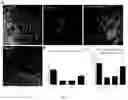 Fig. 14 - METHODS FOR DIAGNOSING AND TREATING METASTATIC CANCER