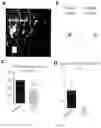 Fig. 15 - METHODS FOR DIAGNOSING AND TREATING METASTATIC CANCER