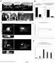 Fig. 17 - METHODS FOR DIAGNOSING AND TREATING METASTATIC CANCER