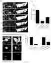 Fig. 19 - METHODS FOR DIAGNOSING AND TREATING METASTATIC CANCER