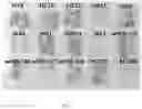 Fig. 06 - METHODS AND COMPOSITION FOR TRANSFERRING T-DNA INTO A PLANT