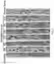 Fig. 03 - WHEAT STEM RUST RESISTANCE GENES AND METHODS OF USE