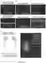 Fig. 10 - GENETIC TARGETING OF CELLULAR OR NEURONAL SUB-POPULATIONS