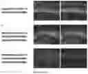 Fig. 13 - GENETIC TARGETING OF CELLULAR OR NEURONAL SUB-POPULATIONS