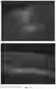 Fig. 19 - GENETIC TARGETING OF CELLULAR OR NEURONAL SUB-POPULATIONS