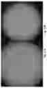 Fig. 09 - METHANATION METHOD IN A BIOREACTOR UNDER CONTINUOUS CELL-RETENTION CONDITIONS